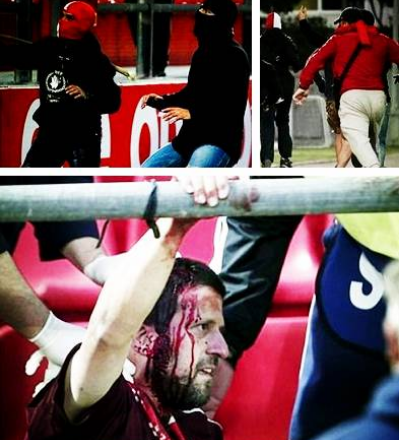 令人发指！拜仁球迷青年欧冠遭袭 现场血肉模糊_比赛
